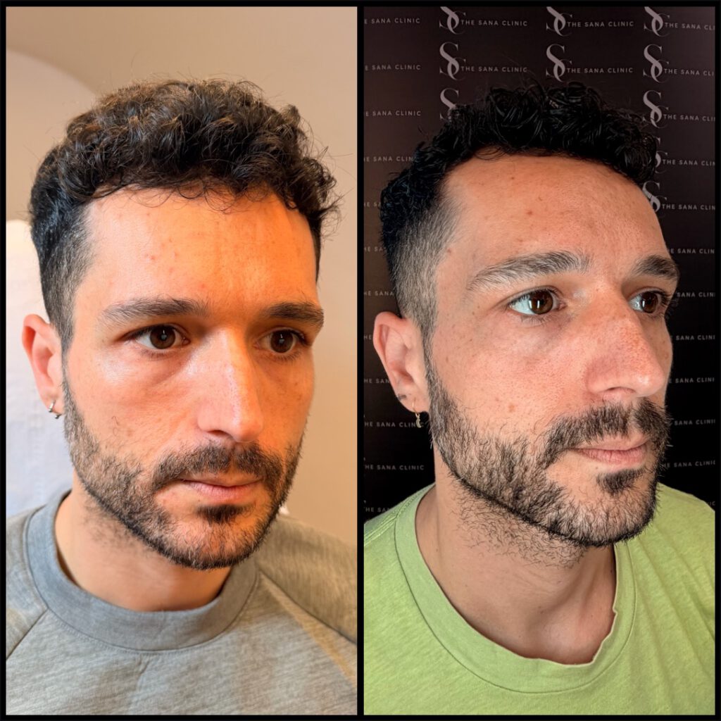 Anti-Wrinkle Treatments