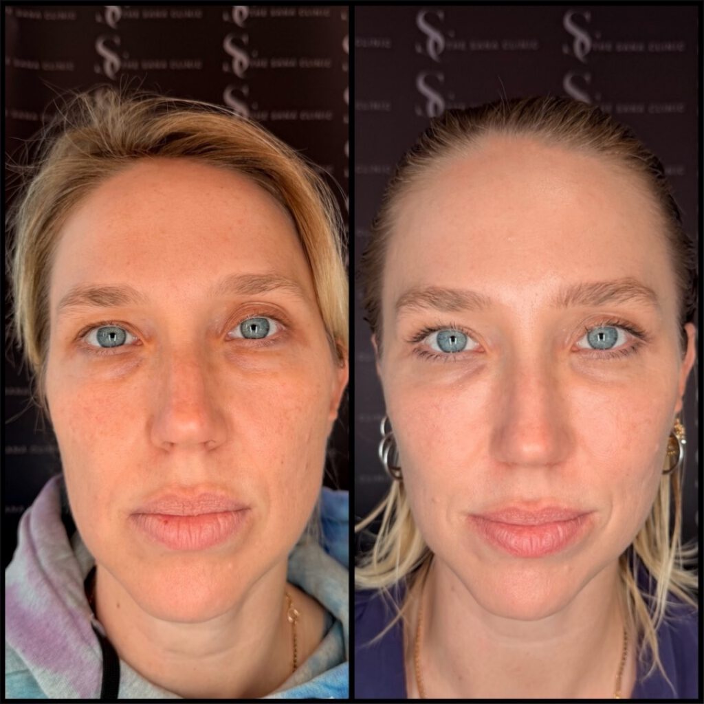 Facial Balancing and Skin Treatments. 