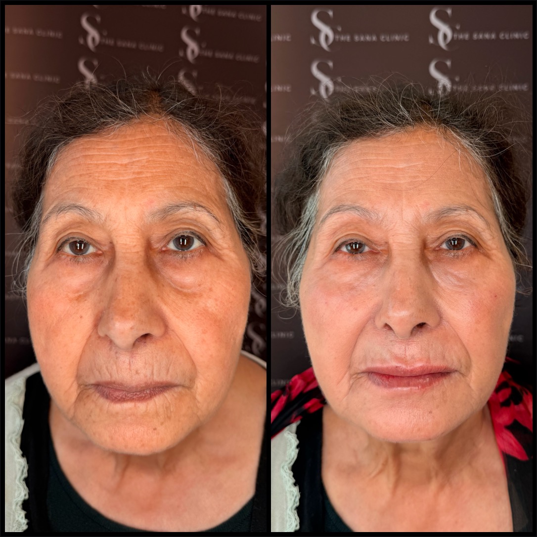 old lady transformation