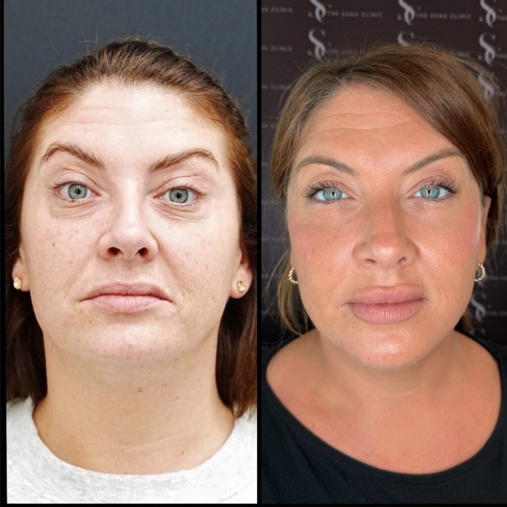 Full Facial Balancing and Skin Treatments