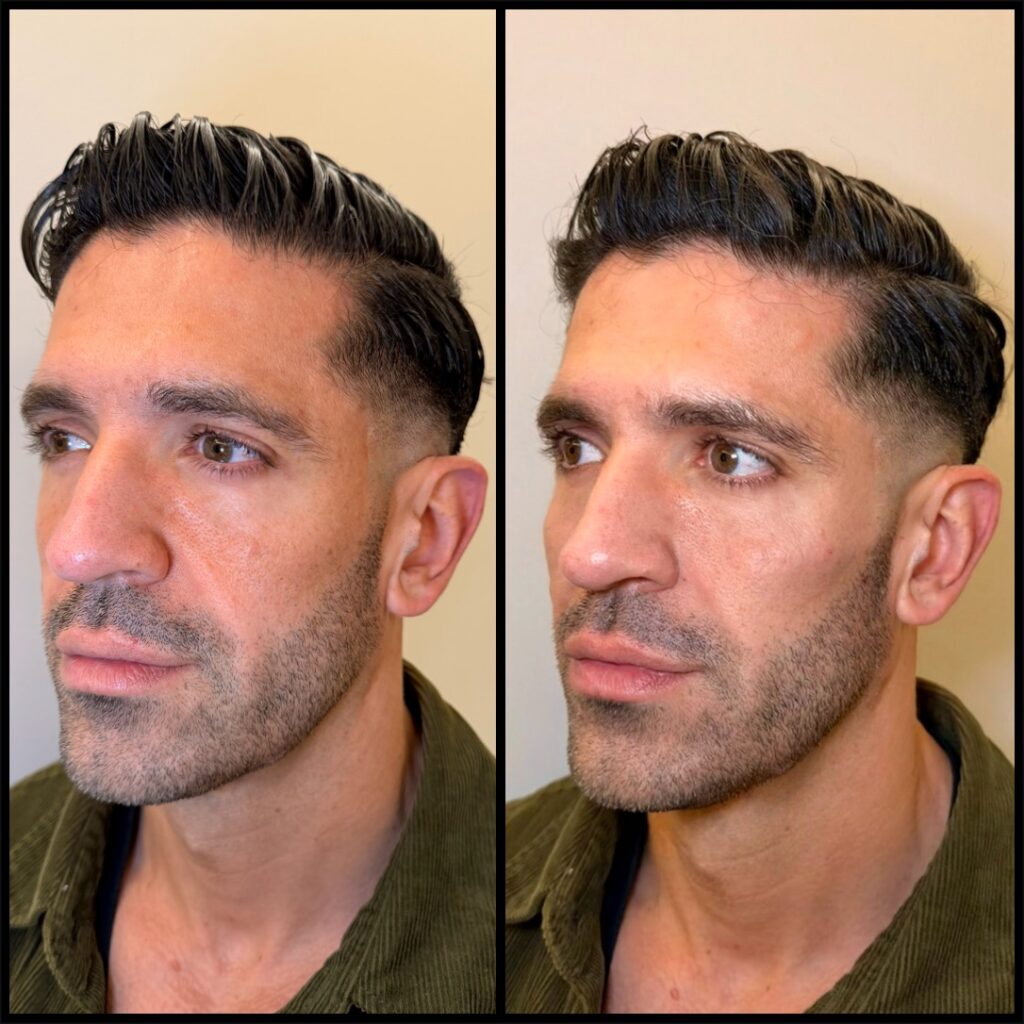 Facial Restorative Treatment 