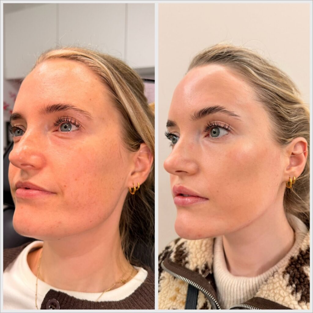 Full Facial Balancing and Skin Treatments